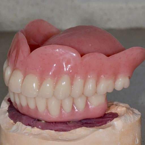 Advantages of dentures