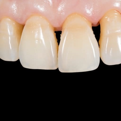 Periodontal Treatment