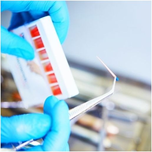 Root Canal Procedure