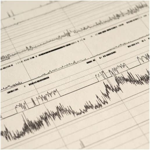 Sleep Study and Diagnosis